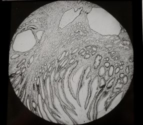 black and white image of tissue sample viewed under microscope