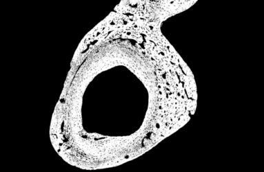Black and white photo of microscopic image of bone structure male