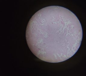 microscope view of tissue sample on slide