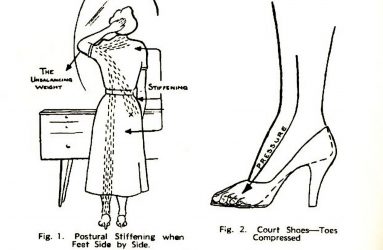 line drawing showing woman wearing heels standing with feet together, arrows highlight areas of strain