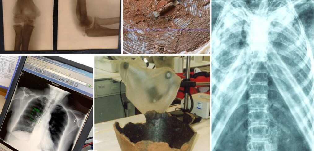 Montage images of xrays for archaeology