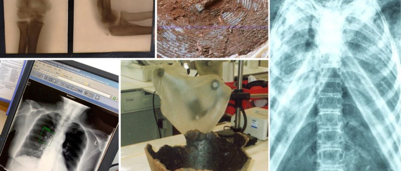Montage images of xrays for archaeology