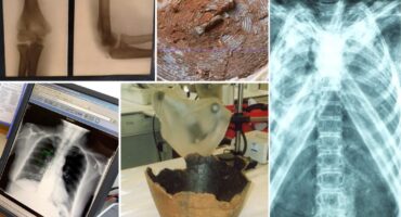 Montage images of xrays for archaeology